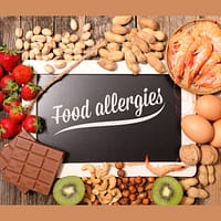 FOOD ALLERGIES / INTOLERANCES